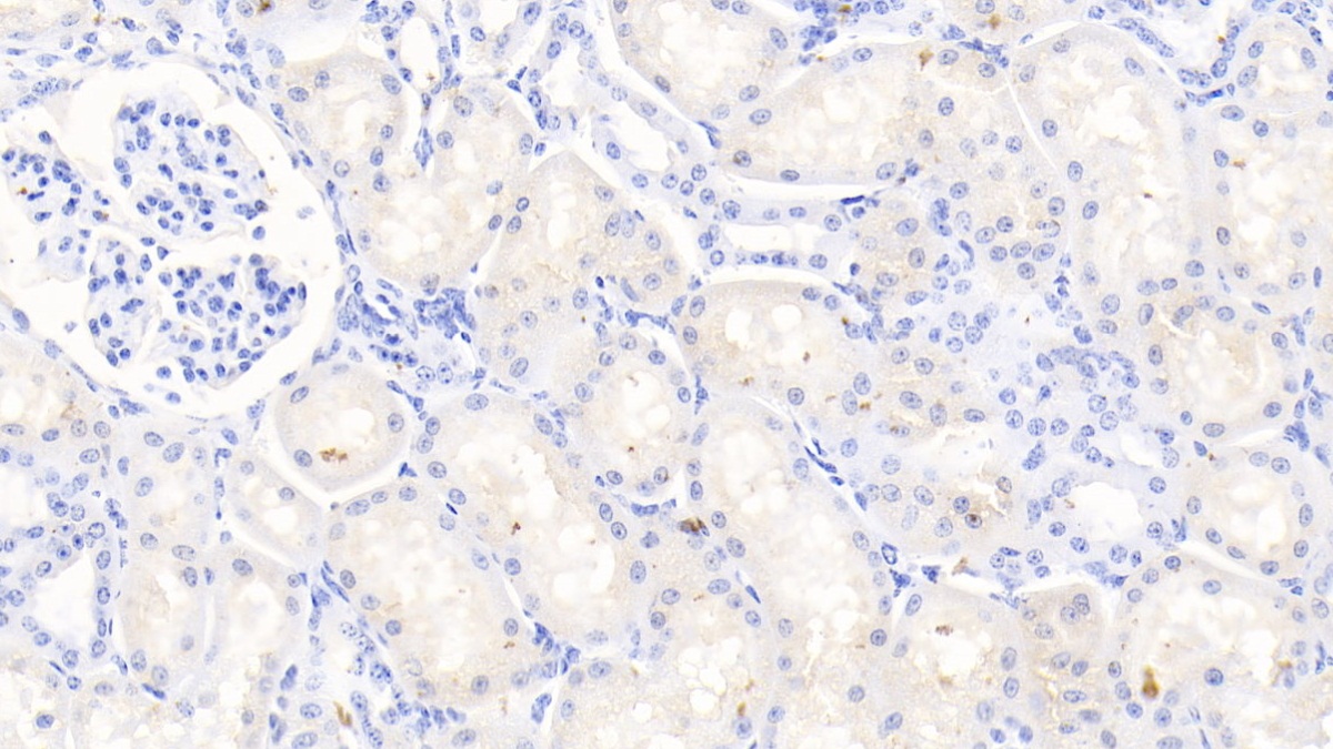 Polyclonal Antibody to Matrix Metalloproteinase 3 (MMP3)