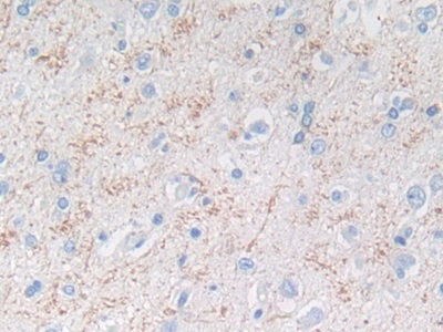 Polyclonal Antibody to Matrix Metalloproteinase 3 (MMP3)