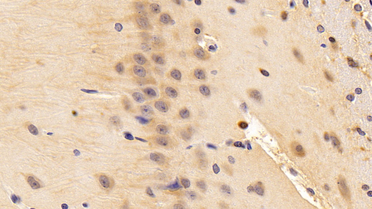 Polyclonal Antibody to Nerve Growth Factor (NGF)