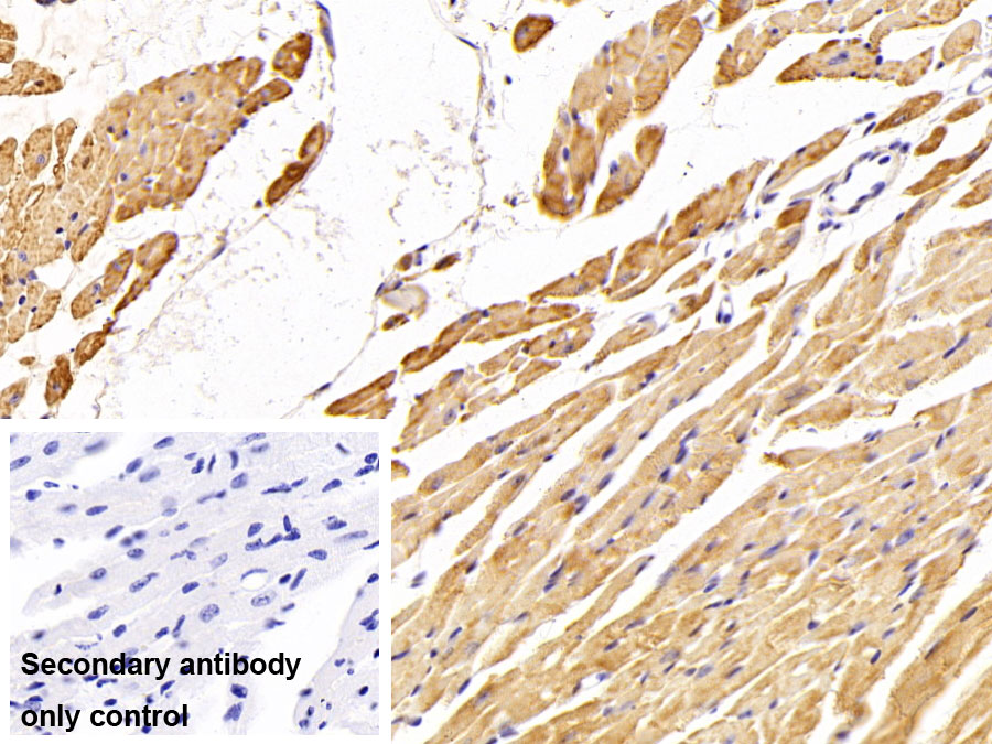 Polyclonal Antibody to Creatine Kinase, Muscle (CKM)
