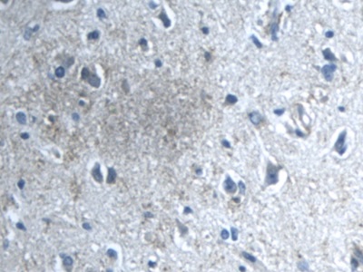 Polyclonal Antibody to Transforming Growth Factor Beta Induced Protein (TGFbI)