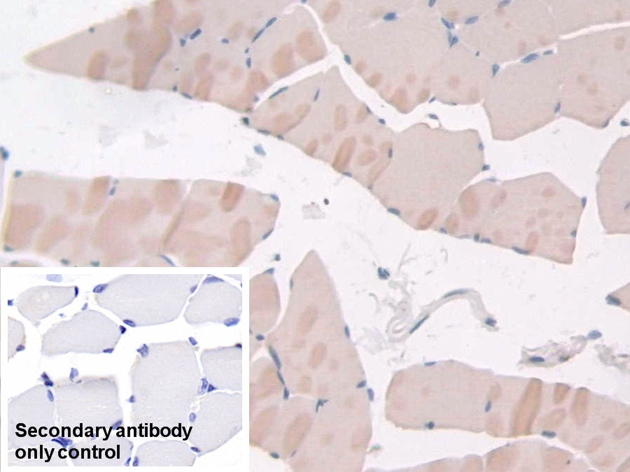 Polyclonal Antibody to Adiponectin Receptor 2 (ADIPOR2)