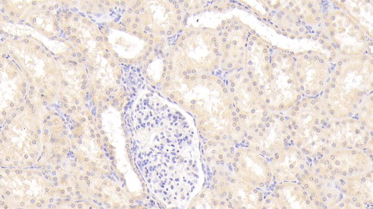 Polyclonal Antibody to Alpha 2-Antiplasmin (a2PI)