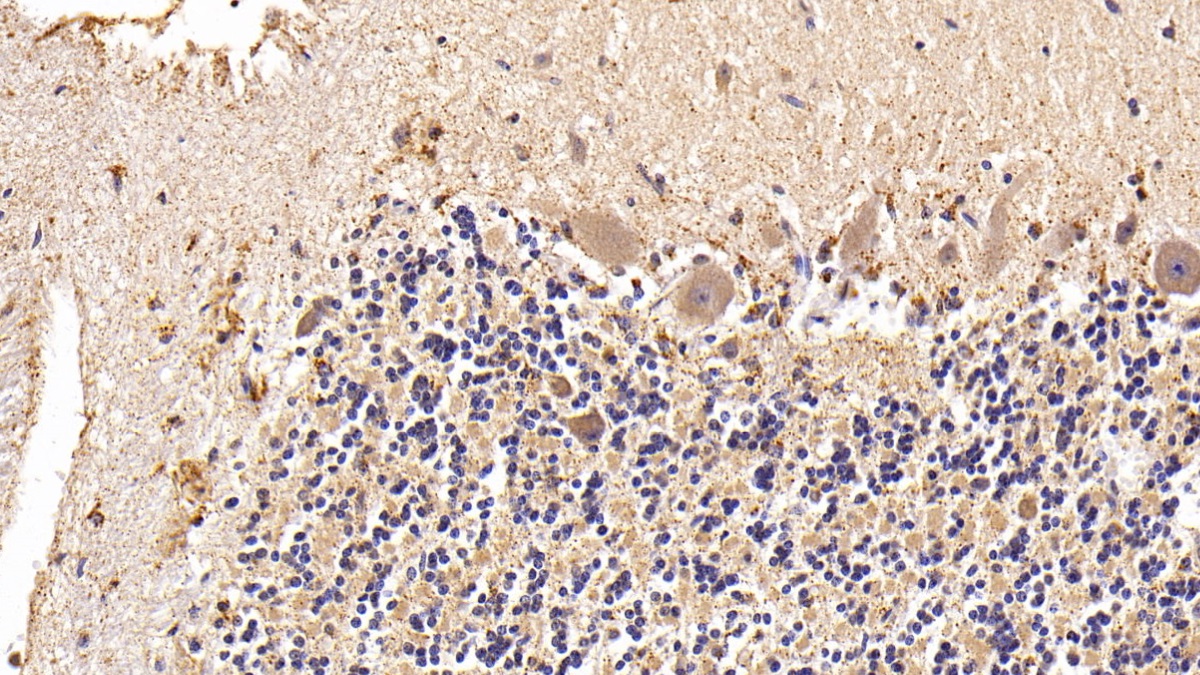 Polyclonal Antibody to Galactosidase Beta (GLb)