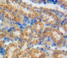 Polyclonal Antibody to Growth Arrest Specific Protein 6 (GAS6)