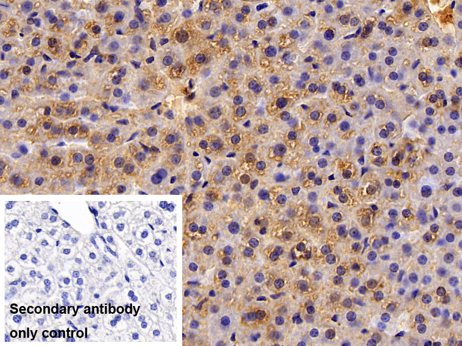 Polyclonal Antibody to Alanine Aminotransferase (ALT)