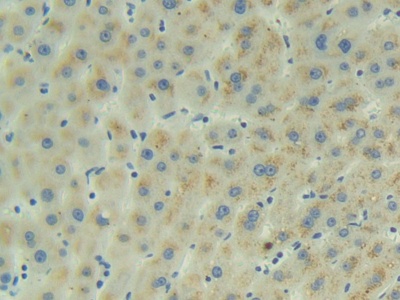 Polyclonal Antibody to Adrenomedullin (ADM)