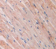 Polyclonal Antibody to Atrial Natriuretic Peptide (ANP)