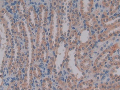 Polyclonal Antibody to Anti-Mullerian Hormone (AMH)