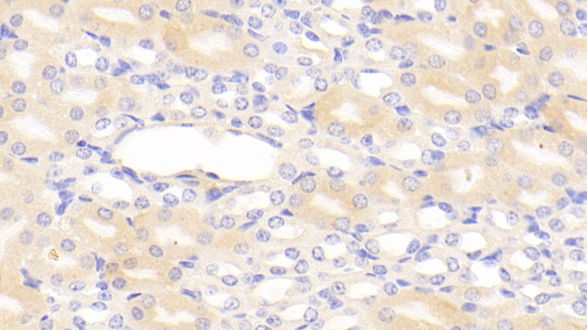 Polyclonal Antibody to Complement 1 Inhibitor (C1INH)