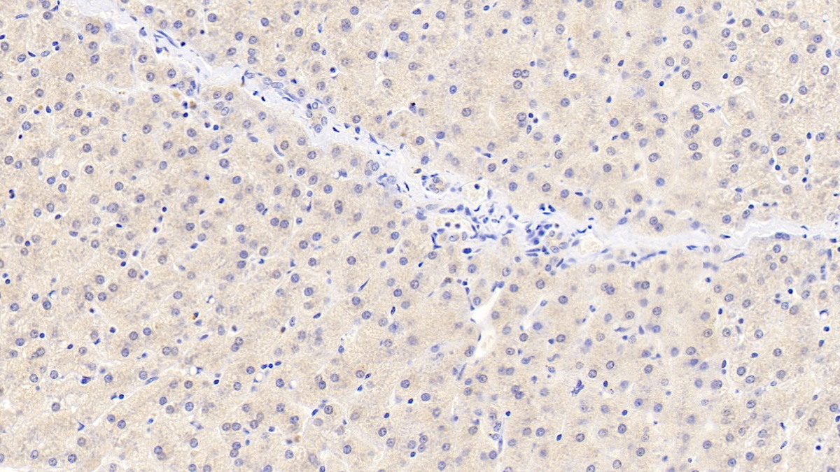 Polyclonal Antibody to Tyrosinase (TYR)