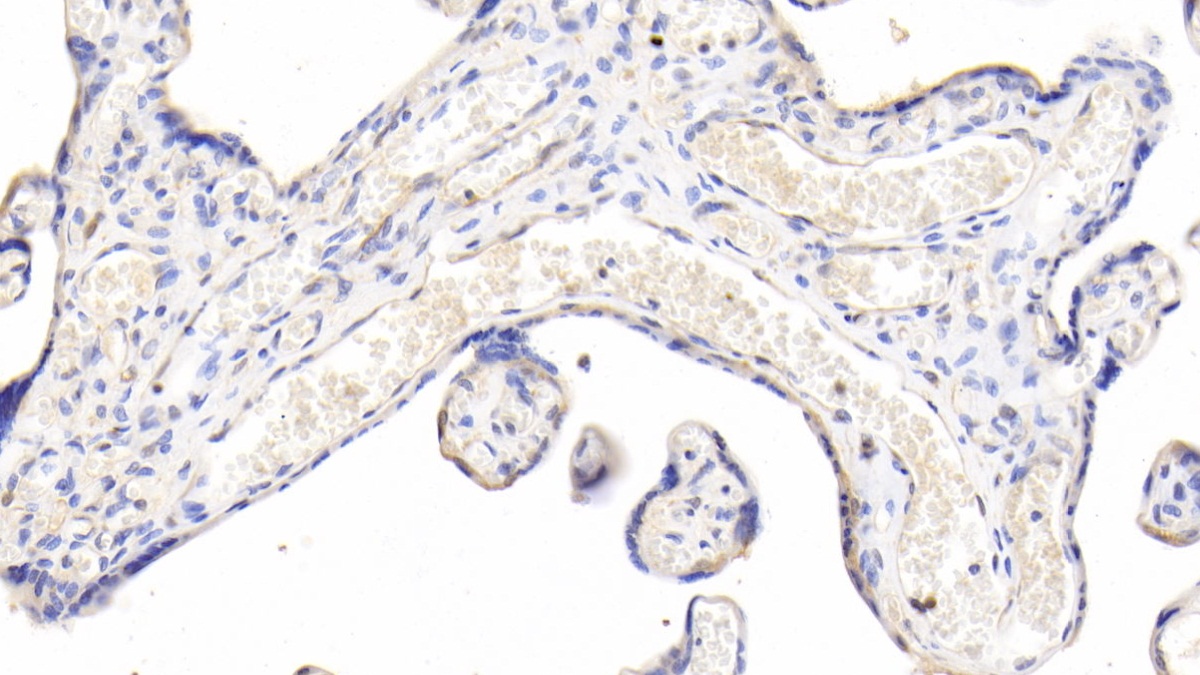 Polyclonal Antibody to Caspase 2 (CASP2)