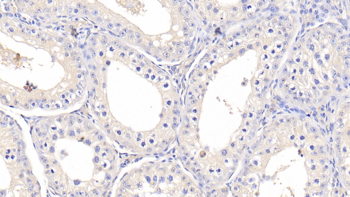 Polyclonal Antibody to Cathepsin K (CTSK)