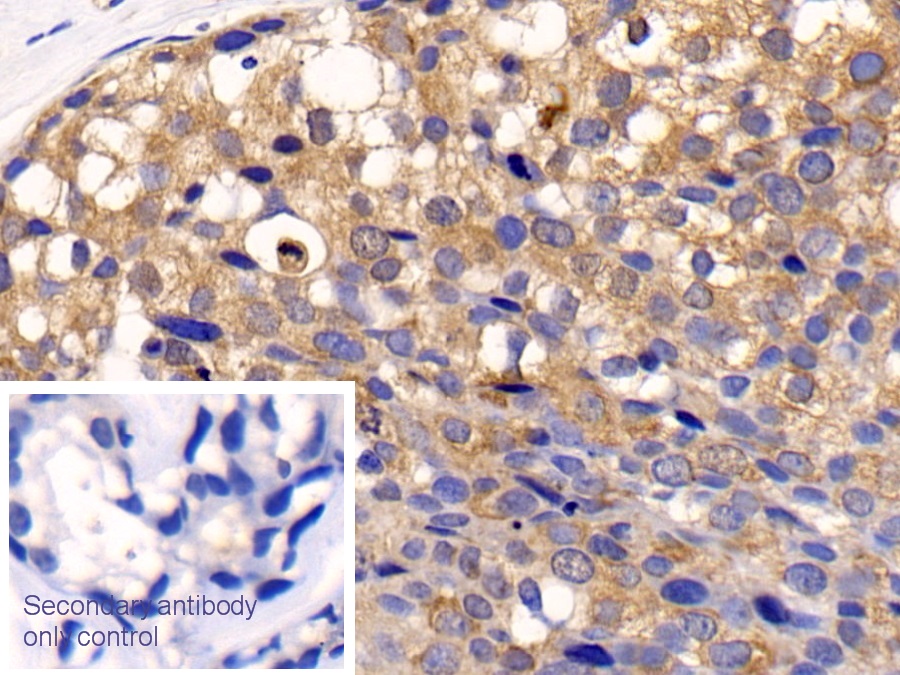 Polyclonal Antibody to Cathepsin K (CTSK)