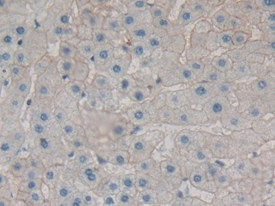 Polyclonal Antibody to Alpha-Fodrin (SPTAN1)