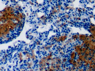 Polyclonal Antibody to Galectin 3 (GAL3)