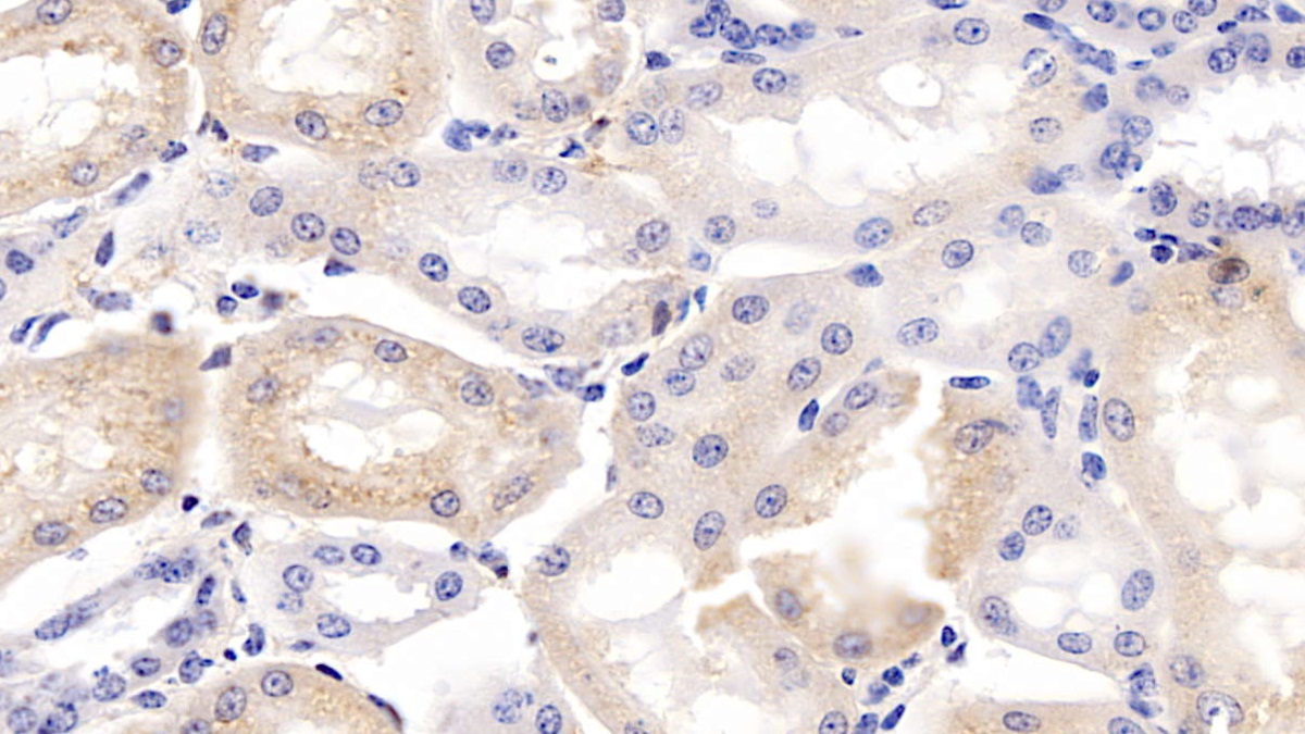 Polyclonal Antibody to Apolipoprotein H (APOH)