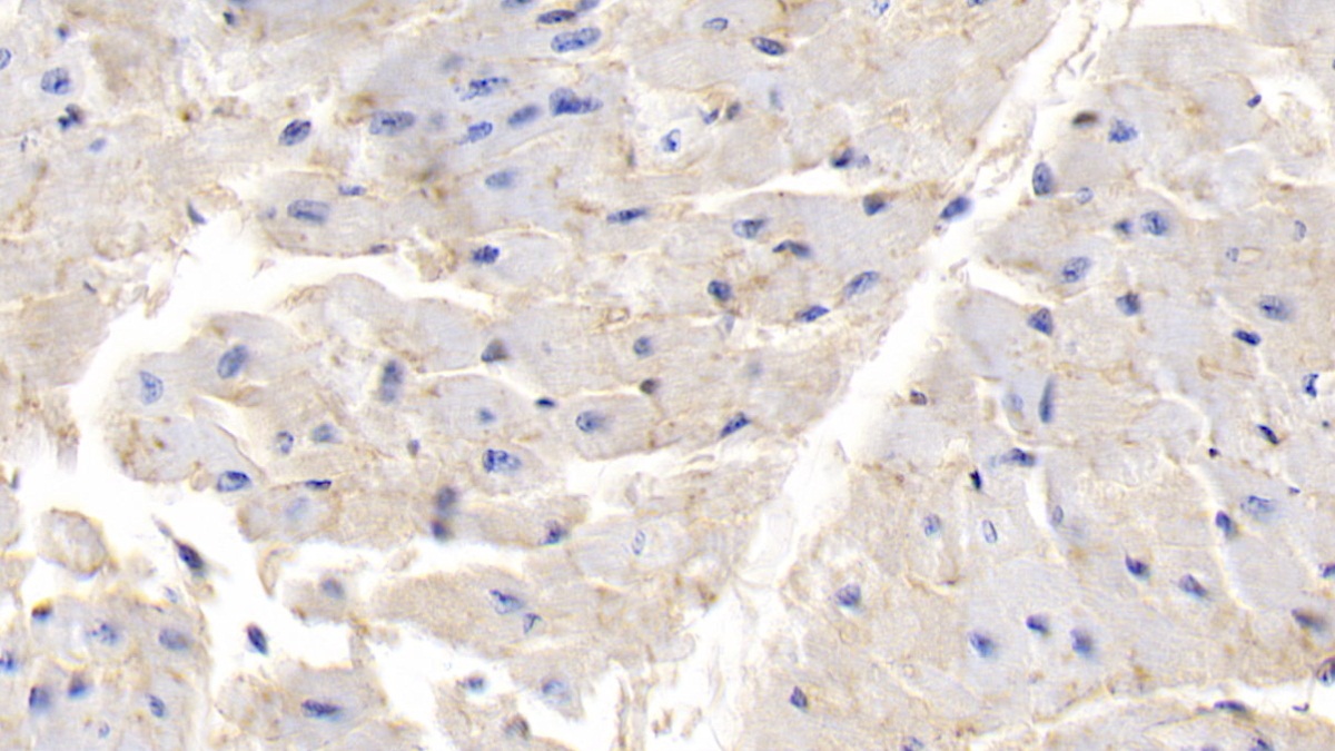 Polyclonal Antibody to Galectin 1 (GAL1)