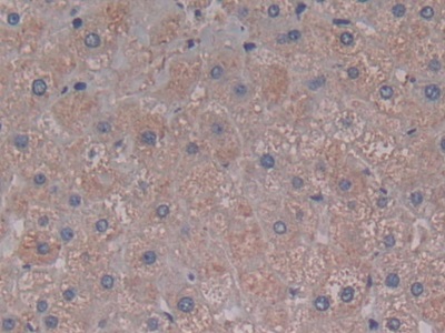 Polyclonal Antibody to Complement Component 5a (C5a)