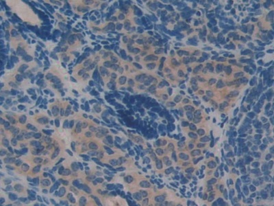 Polyclonal Antibody to Protein Kinase Inhibitor Gamma (PKIg)