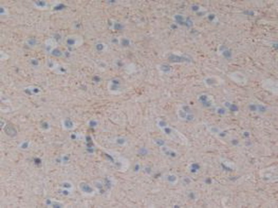 Polyclonal Antibody to Substance P (SP)