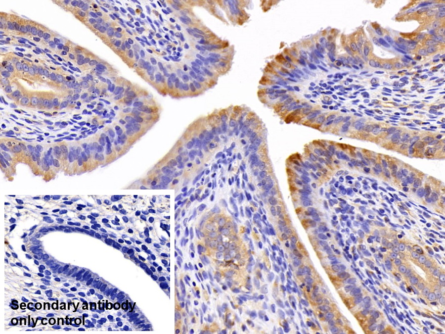 Polyclonal Antibody to Retinol Binding Protein 1, Cellular (RBP1)