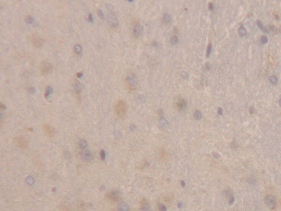 Polyclonal Antibody to Retinol Binding Protein 1, Cellular (RBP1)