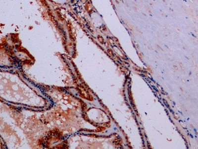 Polyclonal Antibody to Synaptophysin (SYP)