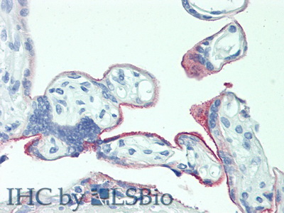 Polyclonal Antibody to 5T4