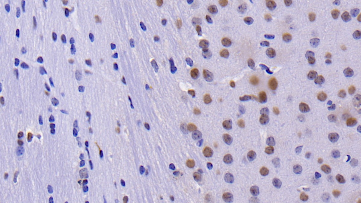 Polyclonal Antibody to Caspase 14 (CASP14)
