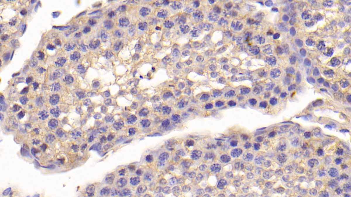 Polyclonal Antibody to Osteocalcin (OC)