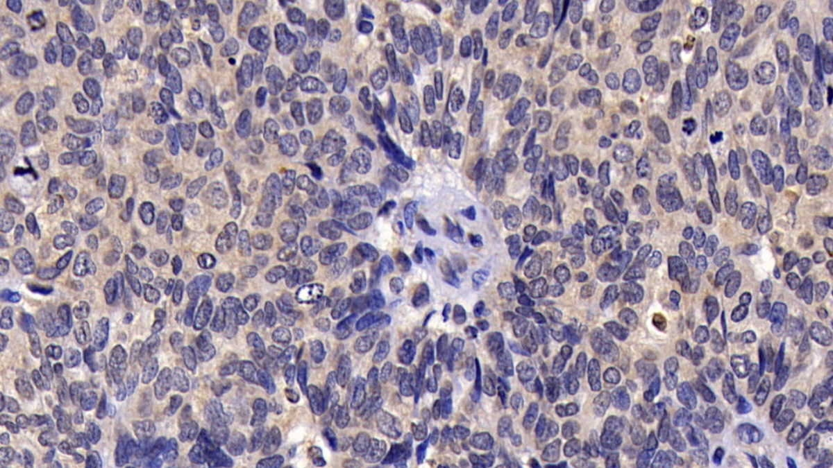 Polyclonal Antibody to Calcitonin (CT)