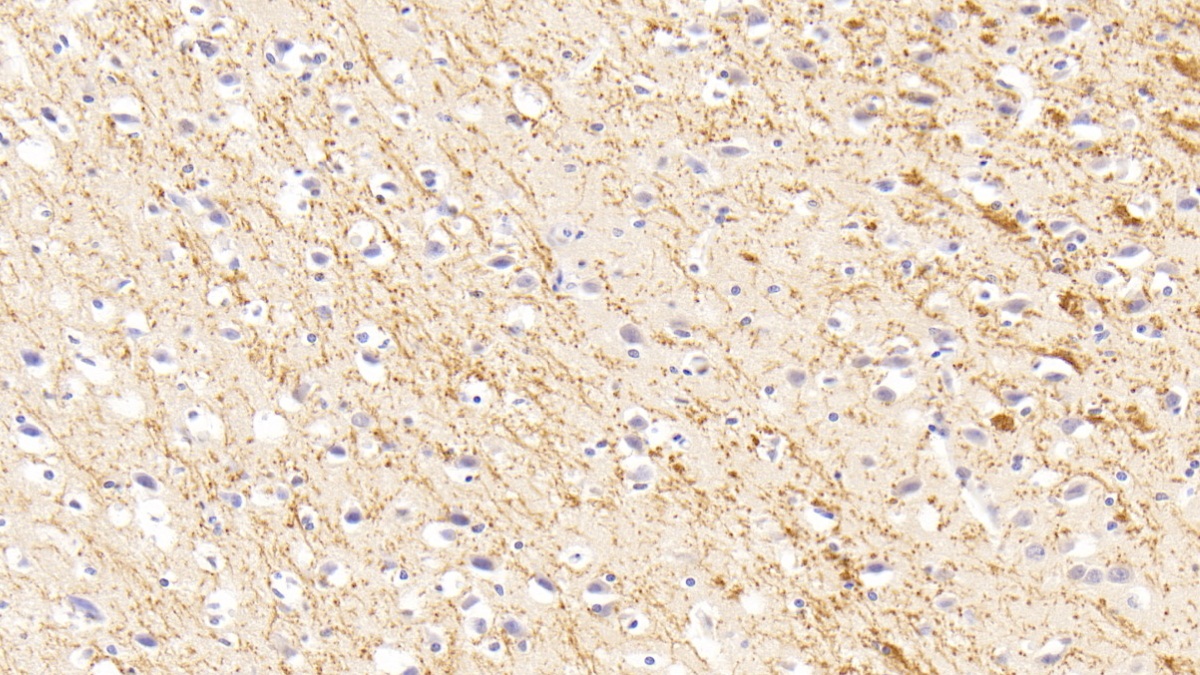 Polyclonal Antibody to Parathyroid Hormone Receptor 2 (PTHR2)