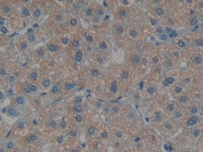 Polyclonal Antibody to Endothelin 1 (EDN1)