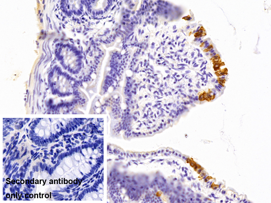 Polyclonal Antibody to Keratin 2 (CK2)