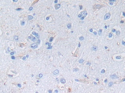 Polyclonal Antibody to Nestin (NES)