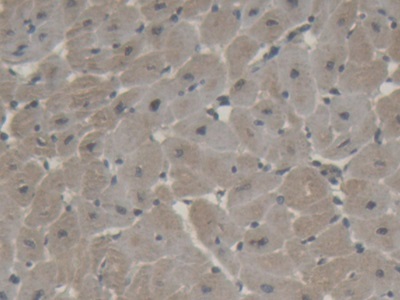 Polyclonal Antibody to Natriuretic Peptide Precursor B (NPPB)