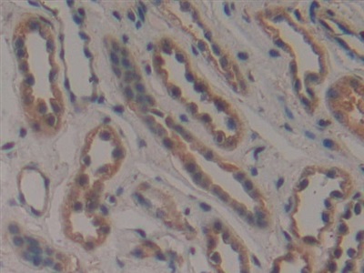 Polyclonal Antibody to Coilin (COIL)