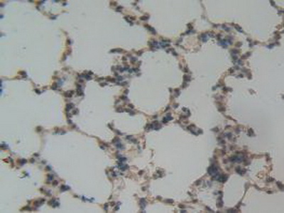 Polyclonal Antibody to Plasminogen Activator Inhibitor 1 (PAI1)