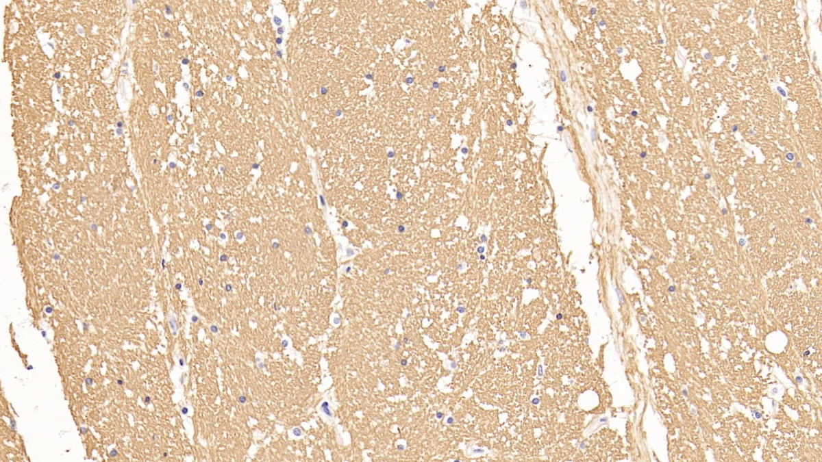 Polyclonal Antibody to Myelin Basic Protein (MBP)