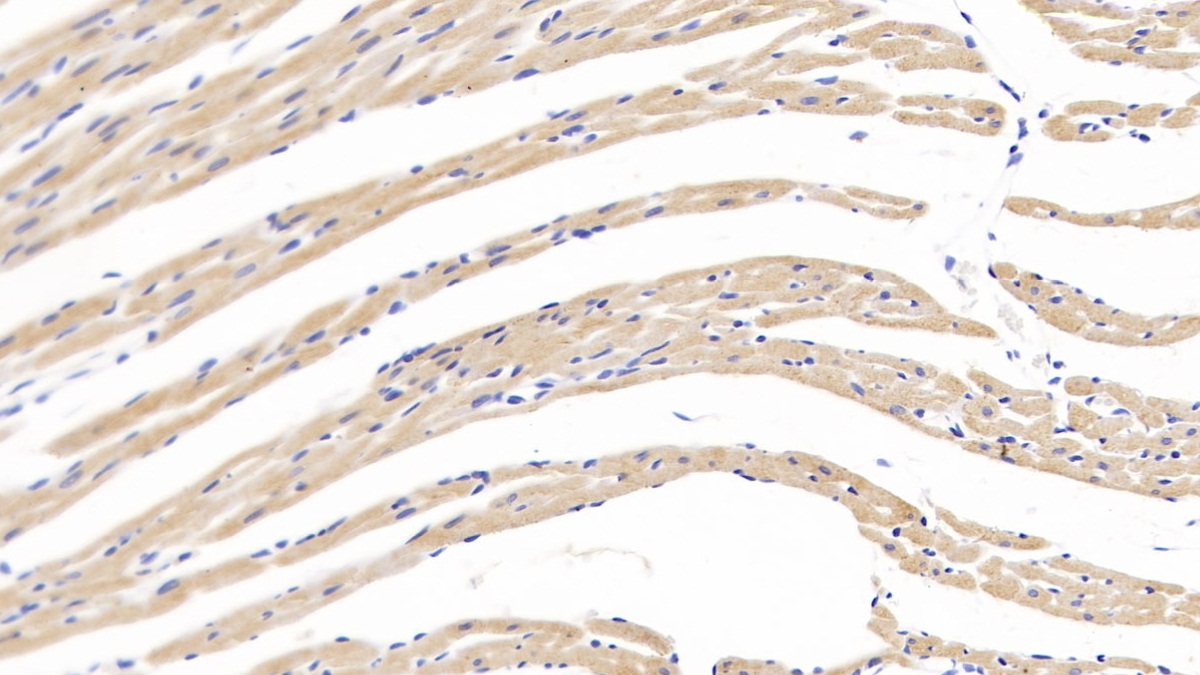 Polyclonal Antibody to Brain Natriuretic Peptide (BNP)