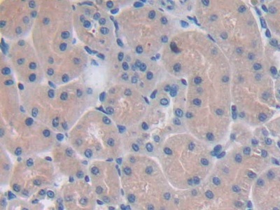Polyclonal Antibody to Nicotinamide Adenine Dinucleotide Phosphate Oxidase 1 (NOX1)