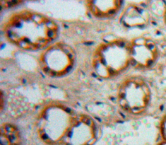 Polyclonal Antibody to Epidermal Growth Factor (EGF)