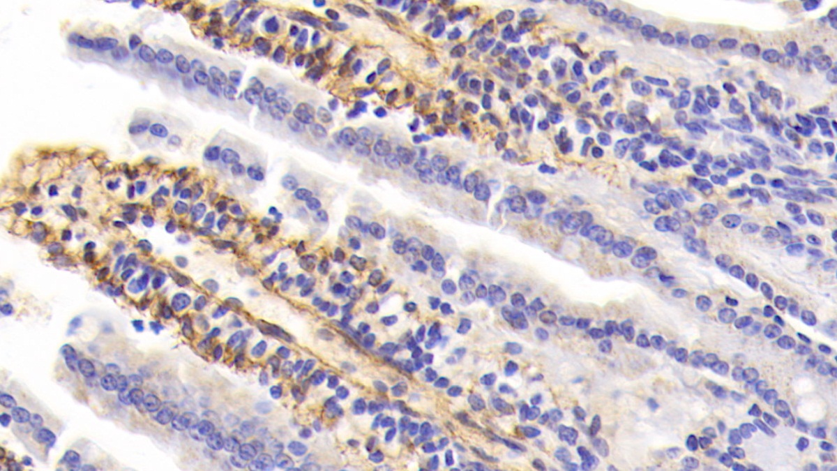 Polyclonal Antibody to Procollagen III N-Terminal Propeptide (PIIINP)