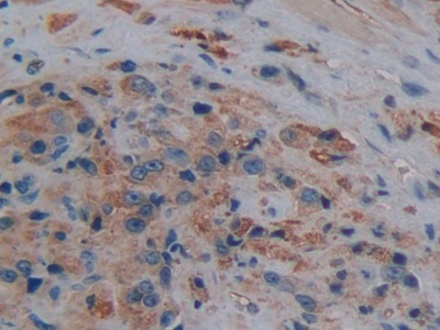 Polyclonal Antibody to Aquaporin 1 (AQP1)
