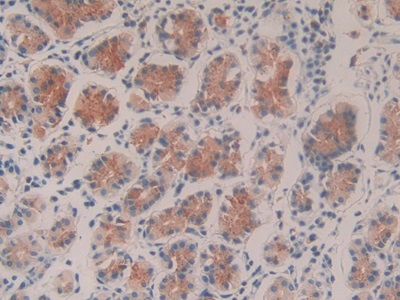 Polyclonal Antibody to Caspase 9 (CASP9)