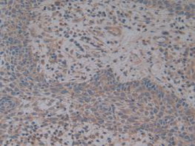 Polyclonal Antibody to Complement Factor H (CFH)