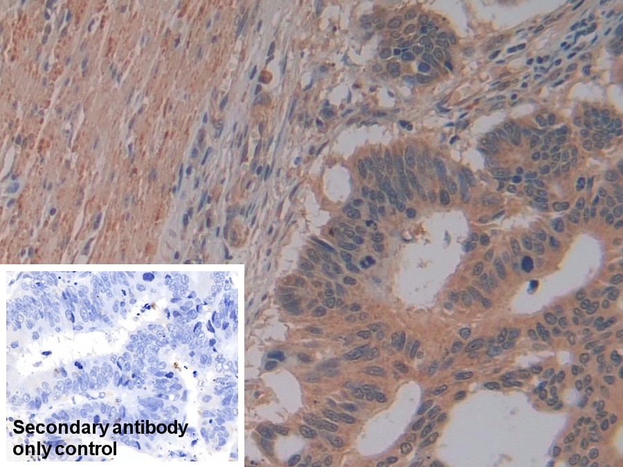 Polyclonal Antibody to Glutathione S Transferase Mu 4 (GSTm4)