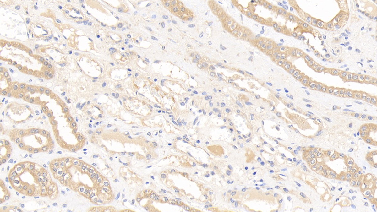Polyclonal Antibody to Glutathione S Transferase Mu 1 (GSTM1)