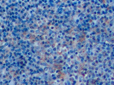 Polyclonal Antibody to Cluster Of Differentiation 14 (CD14)